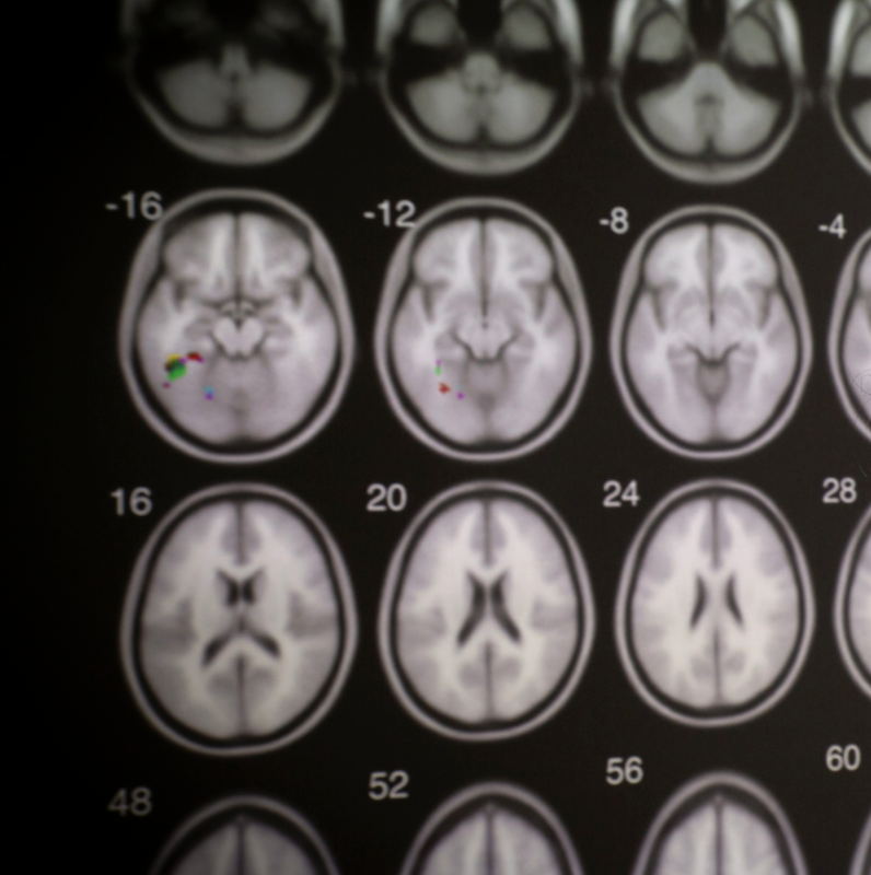 Brain scans. Photo by Joyce Marshall