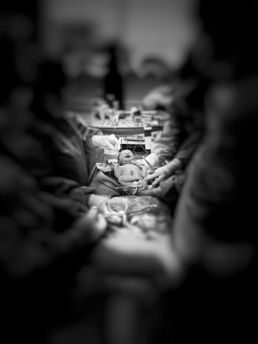 A black and white photo from a hospital delivery room. Everything is out of focus except the new born baby in the center of the photo, held in a doctor's hands.